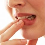 Afty – nepříjemné postižení ústní sliznice – jak na afty?