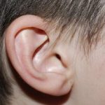 Otoplastika – korekce odstávajících uší
