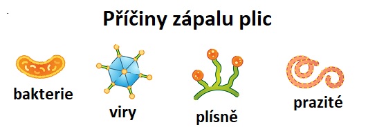 Příčiny zápalu plic