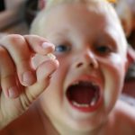Zubní kaz u dětí