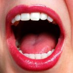 Zuby moudrosti či „osmičky“ a problémy s nimi
