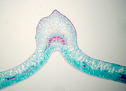 Biologické počítače by mohly najít nádor v lidském těle