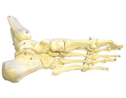 Osteoporóza - hrozí řídnutí kostí i vám?