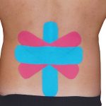 Kinesiotaping – zkuste elastické pásky na bolest i podporu