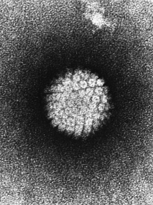 HPV virus neboli lidský papillomavirus