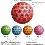 Recidivující (rekurentní) respirační papilomatóza – co je to?