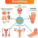 Invazivní kandidóza (kandidémie) – příznaky, příčiny a léčba