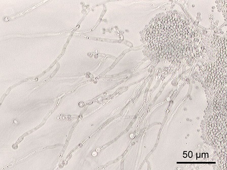 Candida albicans - vše co chcete vědět