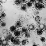 Herpes virus – co ho způsobuje a jak ho dostanete?