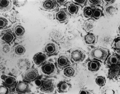 Herpes virus