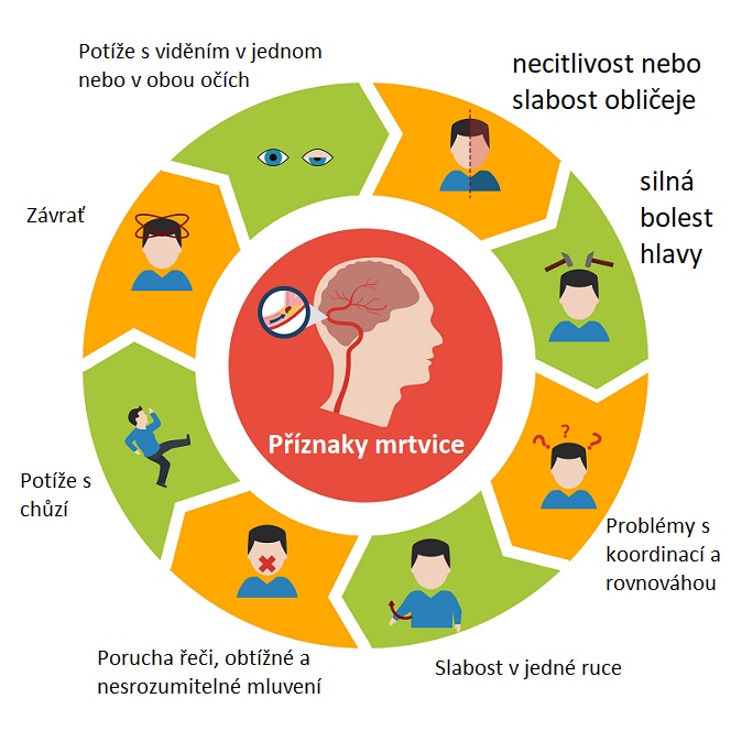 Příznaky mozkové mrtvice - ilustrace