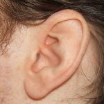 Jak na bolest v uchu? Zkuste tyto babské rady…