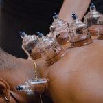 Baňkování neboli vakuová masáž – kdy ji podstoupit?