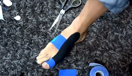 Křivý palec u nohy a kinesio taping