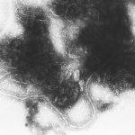 Respirační syncytiální virus (RSV) u dětí – jak na něj? Jak s ním bojovat?