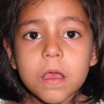 Adenoidní vegetace u dětí – zbytnělá nosní mandle