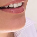 Metody bělení zubů: přírodní, mechanické a chemické
