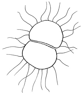 Bakterie Neisseria gonorrhoeae - ta způsobuje kapavku