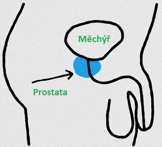 Rakovina prostaty - příčina, projevy a léčba (i bylinkami)