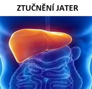 Steatóza obvykle nemá zvláštní příznaky, podle kterých bychom ji dokázali zpozorovat.