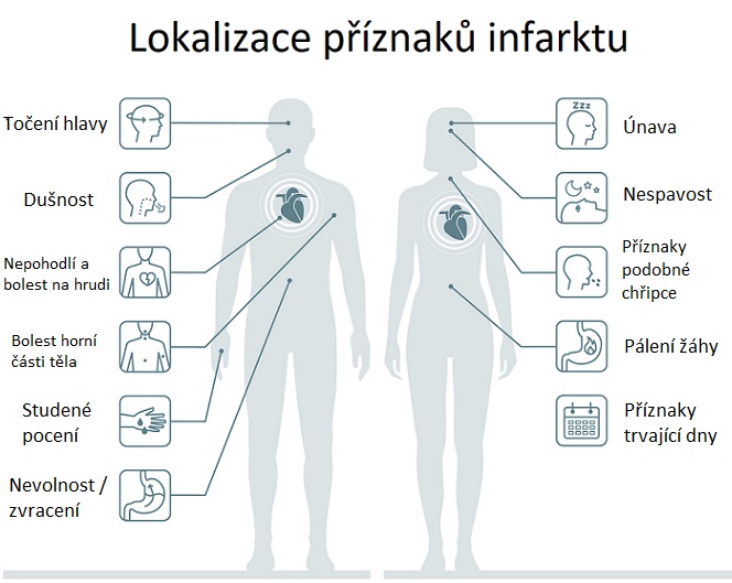 Lokalizace příznaků srdečního infarktu