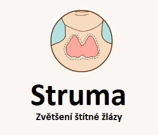 Struma (zvětšená štítná žláza) - příznaky, příčiny, léčba