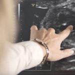 Ultrazvuková vyšetření v průběhu těhotenství