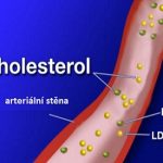 LDL zlý a špatný cholesterol – jak na snížení jeho hladiny v těle?