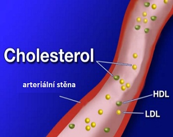 Jak na snížení LDL cholesterolu v těle?