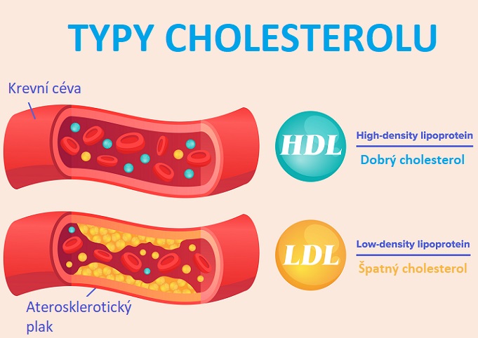 LDL a HDL cholesterol