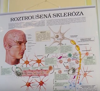 Roztroušená skleróza – když se nepředvídatelné ataky nemoci stanou součástí života...