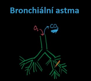 Bronchiální (průduškové) astma - příznaky, léčba