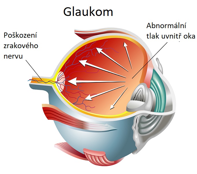 Gaukom - ilustrace