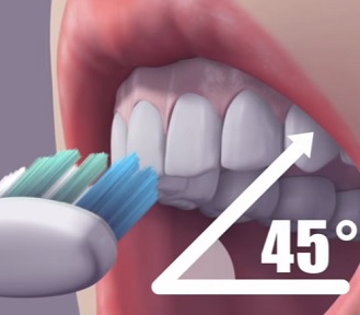 Při čištění zubů je důležitá i pozice kartáčku, která by měla být ve 45-stupňovém úhlu.