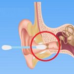 Ušní hygiena – jak na ni správně? Jak si čistit uši?