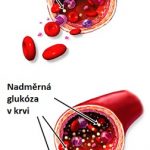 Krevní cukr či vysoká hladina cukru v krvi – jak ji ovlivnit a snížit ji?