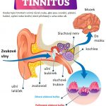 Zvonění v uších? Bílý šum jako úleva od tinnitu