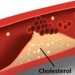 Problém s cholesterolem? Naučte se ho snížit jednoduše