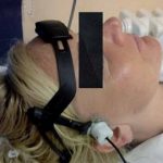 Sonotrombolýza neboli jak zprůchodnit tepnu ultrazvukem