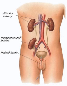 Transplantace ledviny a vše o ní - nejčastější otázky