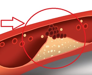 Jak vyzrát na špatný cholesterol? Správnou potravinou!