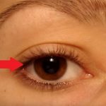 Tiky a cukání v oku (očním víčku) – jaká je příčina?