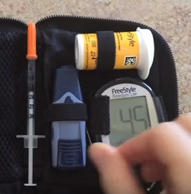 Proč lidé s diabetem 2. typu mají vyšší riziko zlomenin kostí?