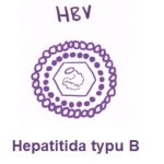 Hepatitida B neboli žloutenka typu B – příčiny, příznaky, léčba