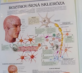 Může zelený ječmen pomoci s roztroušenou sklerózou?