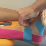 Kinesiotaping z pohledu fyzioterapeuta