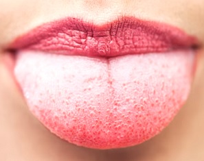Co barva jazyka a jeho celkový stav říká o našem zdraví?
