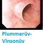 Plummerův-Vinsonův syndrom – příčiny, příznaky, léčba