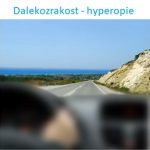 Dalekozrakost (hyperopie) – příznaky, příčiny a léčba