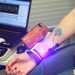 Elektromyografie (EMG) – co je to a jak probíhá?